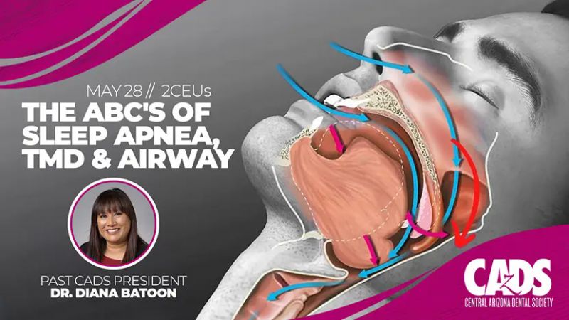 CADS CE Social Club: The ABC`s of Sleep Apnea, TMD and Airway
